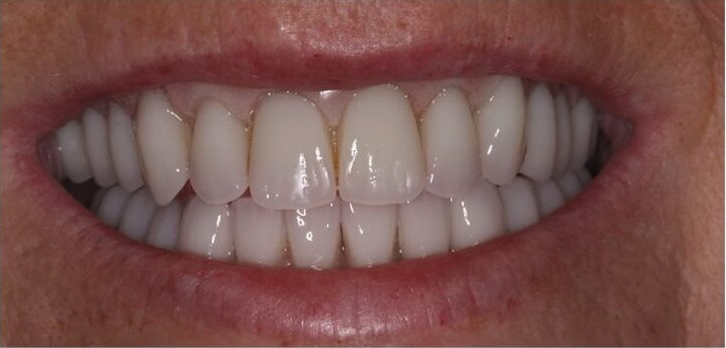Before treatment
