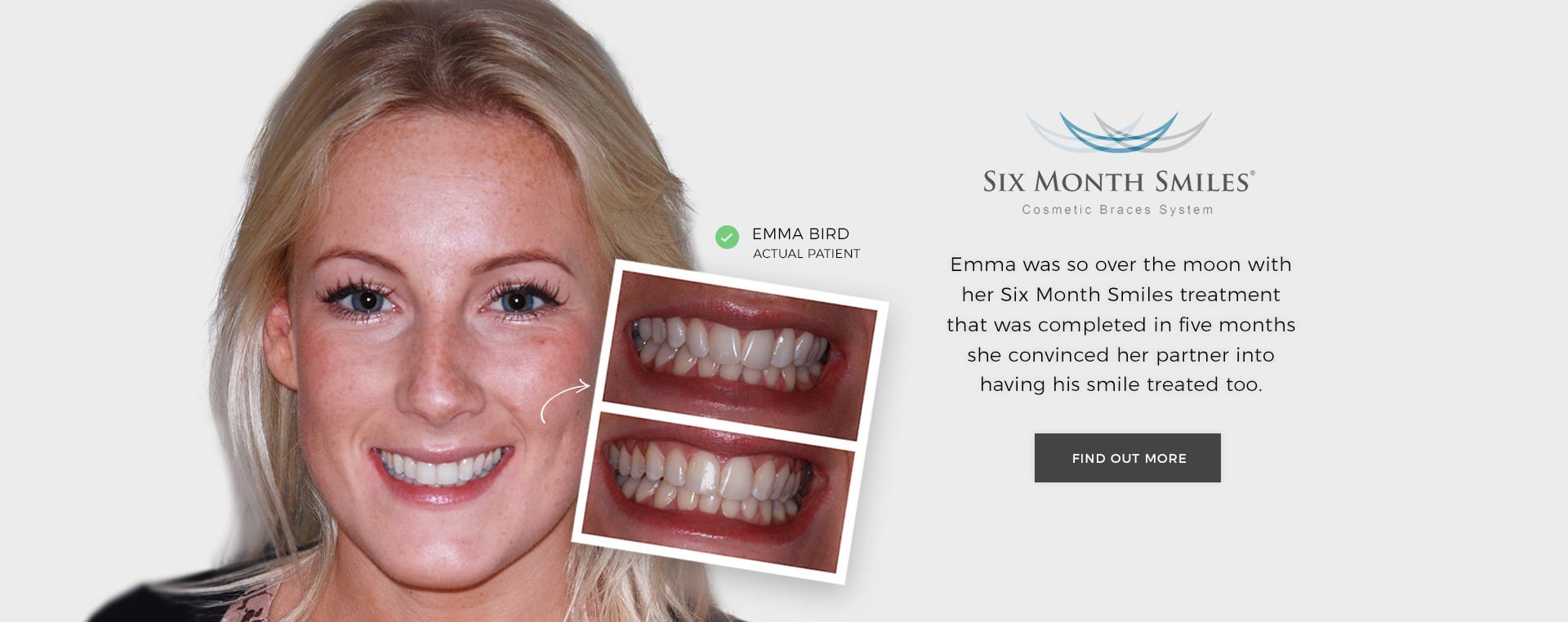 Six Month Smiles Braces Edinburgh - Barnton Dental Spa