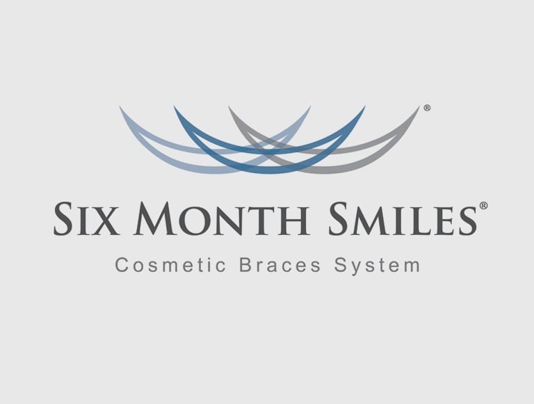 Six Month Smiles - Cosmetic Braces System